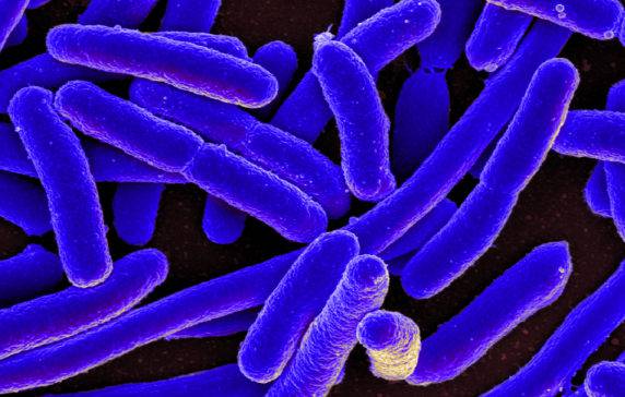Rx E. Coli: New Pill Aims To Use Bacteria To Treat Medical Conditions