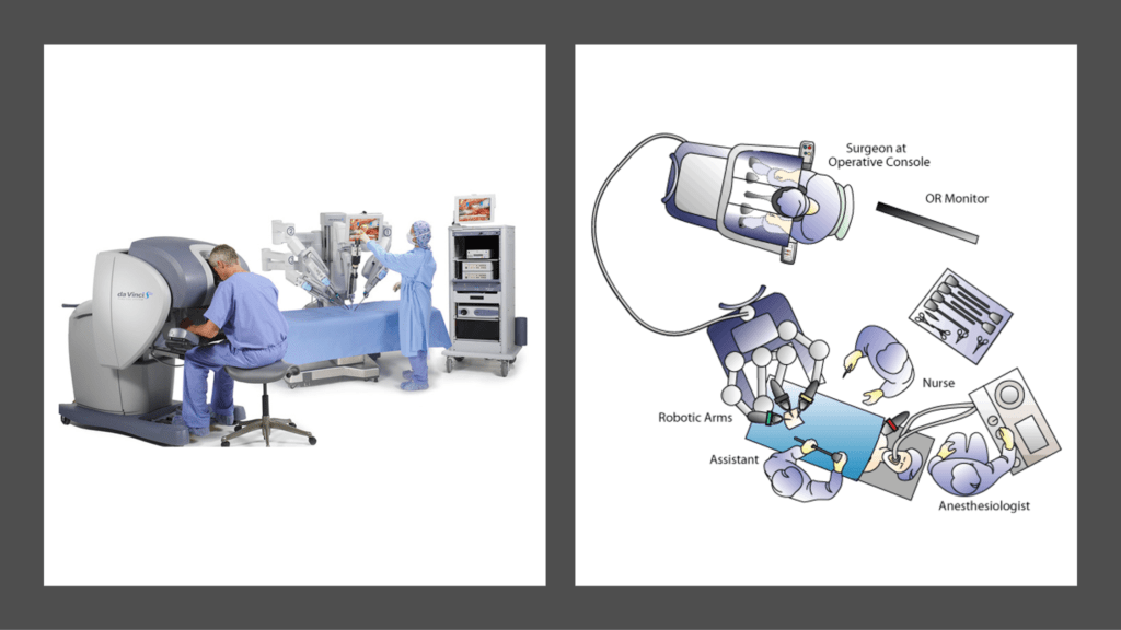 Robotic Surgery Outlook and its Future | CB Insights Research